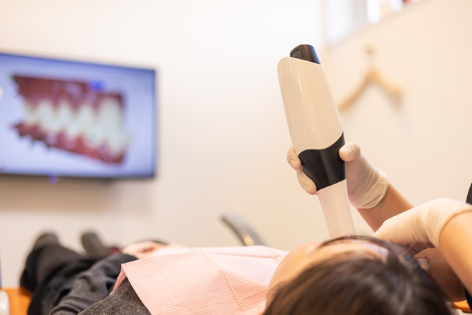 口腔内スキャナー